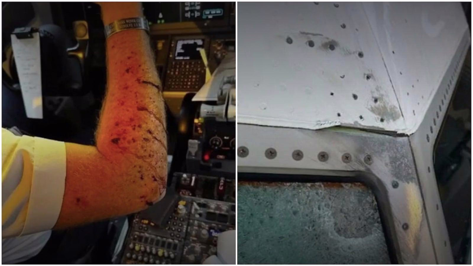 United Airlines Pilot Injured After Windscreen Struck by Weather Balloon